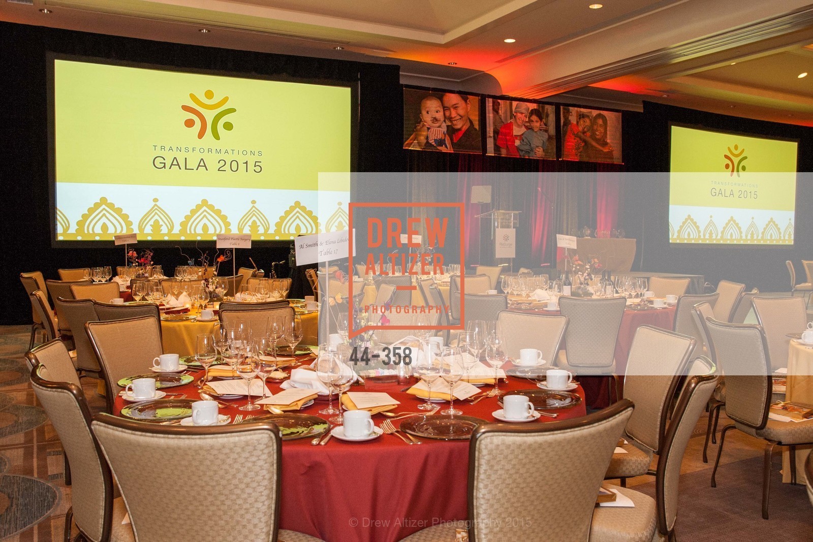 Atmosphere, ReSurge International Gala, Four Seasons San Francisco, October 10th, 2015,Drew Altizer, Drew Altizer Photography, full-service agency, private events, San Francisco photographer, photographer california